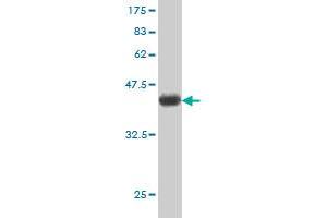 Western Blot detection against Immunogen (37. (UBE2C antibody  (AA 70-179))