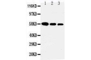 Anti-AHSG antibody, Western blotting Lane 1: Recombinant Human Fetuin A Protein 10ng Lane 2: Recombinant Human Fetuin A Protein 5ng Lane 3: Recombinant Human Fetuin A Protein 2.