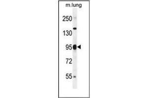 Western blot analysis of PAPR9 Antibody (C-term) in mouse lung tissue lysates (35ug/lane). (PARP9 antibody  (C-Term))