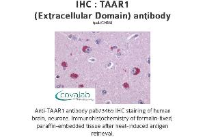 Image no. 1 for anti-Trace Amine Associated Receptor 1 (TAAR1) (2nd Extracellular Domain) antibody (ABIN1739852) (TAAR1 antibody  (2nd Extracellular Domain))
