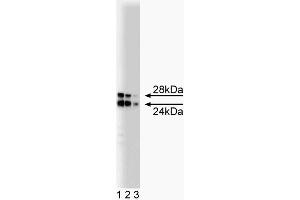 Western Blotting (WB) image for anti-Catechol-O-Methyltransferase (COMT) (AA 26-141) antibody (ABIN968704) (COMT antibody  (AA 26-141))