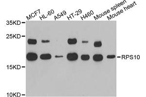 Western blot analysis of extracts of various cell lines, using RPS10 antibody.