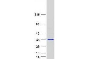 Tetratricopeptide Repeat Domain 33 (TTC33) protein (Myc-DYKDDDDK Tag)