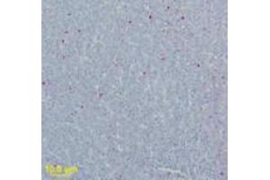 WNVM Immunohistochemistry. (WNV M antibody)