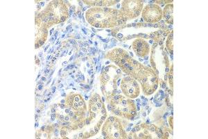 Immunohistochemistry of paraffin-embedded rat kidney using NDUFV2 antibody. (NDUFV2 antibody  (AA 1-249))