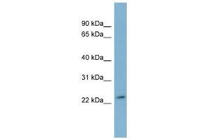Western Blot showing DUXA antibody used at a concentration of 1-2 ug/ml to detect its target protein. (DUXA antibody  (Middle Region))