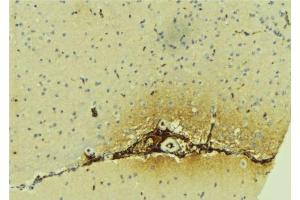 ABIN6279617 at 1/100 staining Mouse brain tissue by IHC-P. (DFNA5 antibody  (C-Term))