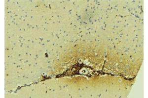 ABIN6279617 at 1/100 staining Mouse brain tissue by IHC-P.