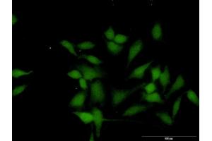 Immunofluorescence of purified MaxPab antibody to WTIP on HeLa cell. (WTIP antibody  (AA 1-430))