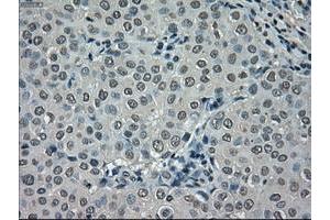 Image no. 2 for anti-NIMA (Never in Mitosis Gene A)-Related Kinase 6 (NEK6) antibody (ABIN1499686) (NEK6 antibody)