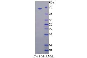 SDS-PAGE (SDS) image for Bestrophin 1 (BEST1) (AA 292-585) protein (His tag,GST tag) (ABIN6239158) (Bestrophin 1 Protein (BEST1) (AA 292-585) (His tag,GST tag))