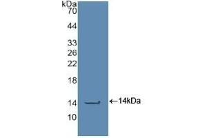 Detection of Recombinant CASP2, Human using Polyclonal Antibody to Caspase 2 (CASP2) (Caspase 2 antibody  (AA 334-452))