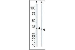 The anti-PRPS1/2/3 Pab (ABIN391076 and ABIN2841223) is used in Western blot to detect PRPS1/2/3 in mouse kidney tissue lysate (Lane 1) and Hela cell lysate (Lane 2). (PRPS1,PRPS2,PRPS3 (AA 79-109), (N-Term) antibody)