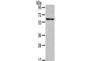 Western Blot analysis of Jurkat cells using GLP2R Polyclonal Antibody at dilution of 1:400 (GLP2R antibody)