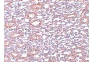 Immunohistochemical staining of rat kidney tissue with PIAS1 polyclonal antibody  at 5 ug/mL dilution.