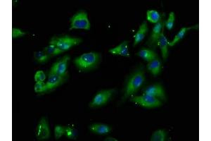 Immunofluorescence staining of Hela cells with ABIN7163303 at 1:100, counter-stained with DAPI. (PIK3IP1 antibody  (AA 22-168))