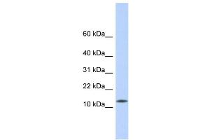 WB Suggested Anti-CDRT4 Antibody Titration: 0. (CDRT4 antibody  (Middle Region))