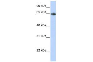 SLC6A2 antibody used at 1 ug/ml to detect target protein. (SLC6A2 antibody)