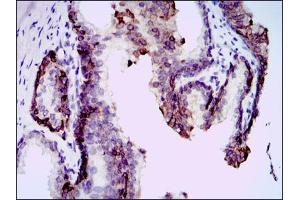 Immunohistochemical analysis of paraffin-embedded prostate tissues using mouse Splunc2 mouse mAb with DAB staining.