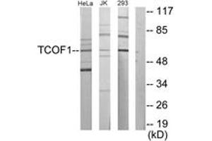Western Blotting (WB) image for anti-Treacher Collins-Franceschetti Syndrome 1 (TCOF1) (AA 41-90) antibody (ABIN2879146) (TCOF1 antibody  (AA 41-90))