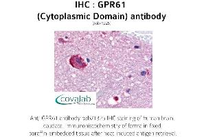 Image no. 1 for anti-G Protein-Coupled Receptor 61 (GPR61) (2nd Cytoplasmic Domain) antibody (ABIN1735131) (GPR61 antibody  (2nd Cytoplasmic Domain))
