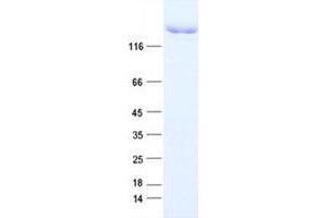 Western Blotting (WB) image for Lysine (K)-Specific Demethylase 5A (KDM5A) protein (DYKDDDDK Tag) (ABIN5505708)