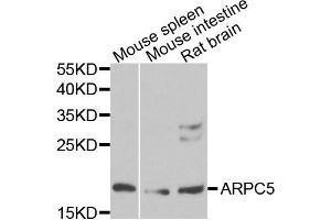 Western blot analysis of extracts of various cells, using ARPC5 antibody. (ARPC5 antibody)
