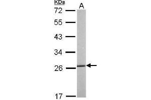 WB Image Sample (50 ug of whole cell lysate) A: mouse liver 12% SDS PAGE antibody diluted at 1:1000 (HSP27 antibody  (Center))