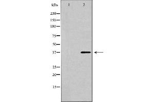 Western blot analysis of extracts of HeLa , using CTGF antibody.