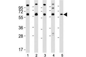 Western blot testing of Pyruvate Kinase antibody at 1:2000 dilution. (PKM2 antibody  (AA 121-151))