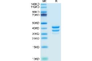 Mouse BAFFR/TNFRSF13C on Tris-Bis PAGE under reduced condition. (TNFRSF13C Protein (AA 10-71) (Fc Tag))