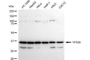 Western blotting analysis using VPS26 antibody (ABIN7800816).