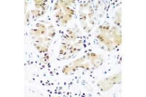 Immunohistochemistry of paraffin-embedded human stomach using AGO2 antibody (ABIN5973585) at dilution of 1/100 (40x lens). (AGO2 antibody)