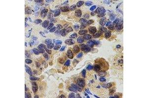 Immunohistochemistry (IHC) image for anti-zeta-Chain (TCR) Associated Protein Kinase 70kDa (ZAP70) (C-Term) antibody (ABIN7304412)