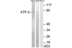 Western blot analysis of extracts from HeLa/293 cells, using ATF-2 (Ab-472) Antibody. (ATF2 antibody  (AA 441-490))