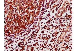 IHC image of ABIN7169831 diluted at 1:500 and staining in paraffin-embedded human lymph node tissue performed on a Leica BondTM system. (SCIMP antibody  (AA 59-145))