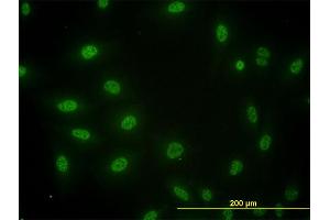 Immunofluorescence of monoclonal antibody to SMAD3 on HeLa cell. (SMAD3 antibody  (AA 1-110))