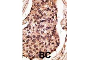 Immunohistochemistry (IHC) image for anti-Sialic Acid Binding Ig-Like Lectin 8 (SIGLEC8) antibody (ABIN2998632) (SIGLEC8 antibody)