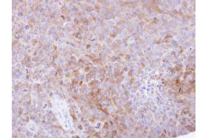 IHC-P Image Immunohistochemical analysis of paraffin-embedded H1299 xenograft , using CKAP1, antibody at 1:500 dilution. (TBCB antibody)