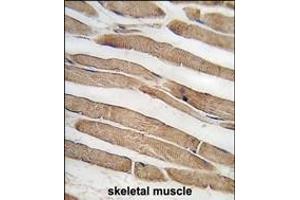 Formalin-fixed and paraffin-embedded human skeletal muscle tissue reacted with ITGB1BP3 antibody (N-term) (ABIN389290 and ABIN2839411) , which was peroxidase-conjugated to the secondary antibody, followed by DAB staining. (ITGB1BP3 antibody  (N-Term))