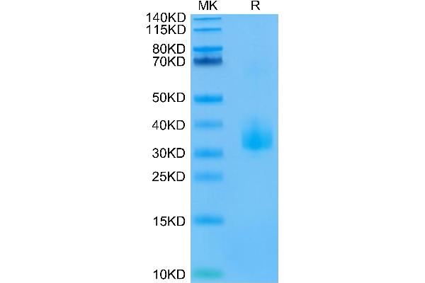 ANGPTL3 Protein (His-Avi Tag,Biotin)