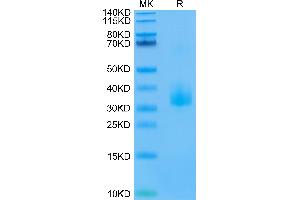 Biotinylated Human ANGPTL3 on Tris-Bis PAGE under reduced conditions. (ANGPTL3 Protein (His-Avi Tag,Biotin))