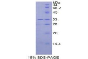SDS-PAGE analysis of Human IL31RA Protein.