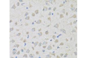 Immunohistochemistry of paraffin-embedded Mouse brain using PENK Polyclonal Antibody at dilution of 1:100 (40x lens). (Enkephalin antibody)