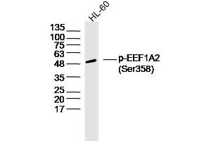 HL60 lysates probed with EEF1A2 (Ser358) Polyclonal Antibody, Unconjugated  at 1:300 dilution and 4˚C overnight incubation.