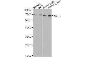 Western blot analysis of extracts of various cell lines, using ZAP70 Antibody. (ZAP70 antibody  (AA 1-300))