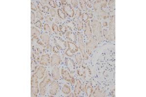 Immunohistochemical analysis of B on paraffin-embedded Human kidney tissue was performed on the Leica®BOND RXm. (SPHK2 antibody  (C-Term))