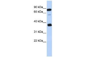 BCAP29 antibody used at 1 ug/ml to detect target protein. (BCAP29 antibody  (Middle Region))