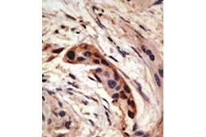 Image no. 2 for anti-Snail Family Zinc Finger 2 (SNAI2) (Middle Region) antibody (ABIN2853627) (SLUG antibody  (Middle Region))