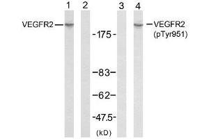 Western blot analysis of extracts from SK-OV3 cells using VEGFR2 (Ab-951) antibody (E021079, Line 1 and 2) and VEGFR2 (phospho-Tyr951) antibody (E011086, Line 3 and 4). (VEGFR2/CD309 antibody  (pTyr951))